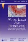 Wound Repair and Regeneration《伤口修复和再生》