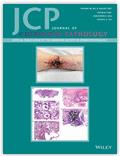 JOURNAL OF CUTANEOUS PATHOLOGY《皮肤病理学杂志》